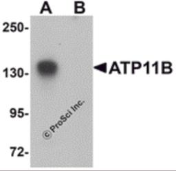 Western blot analysis of ATP11B in K562 cell tissue lysate with ATP11B antibody at 1 μg/mL in (A) the absence and (B) the presence of blocking peptide.