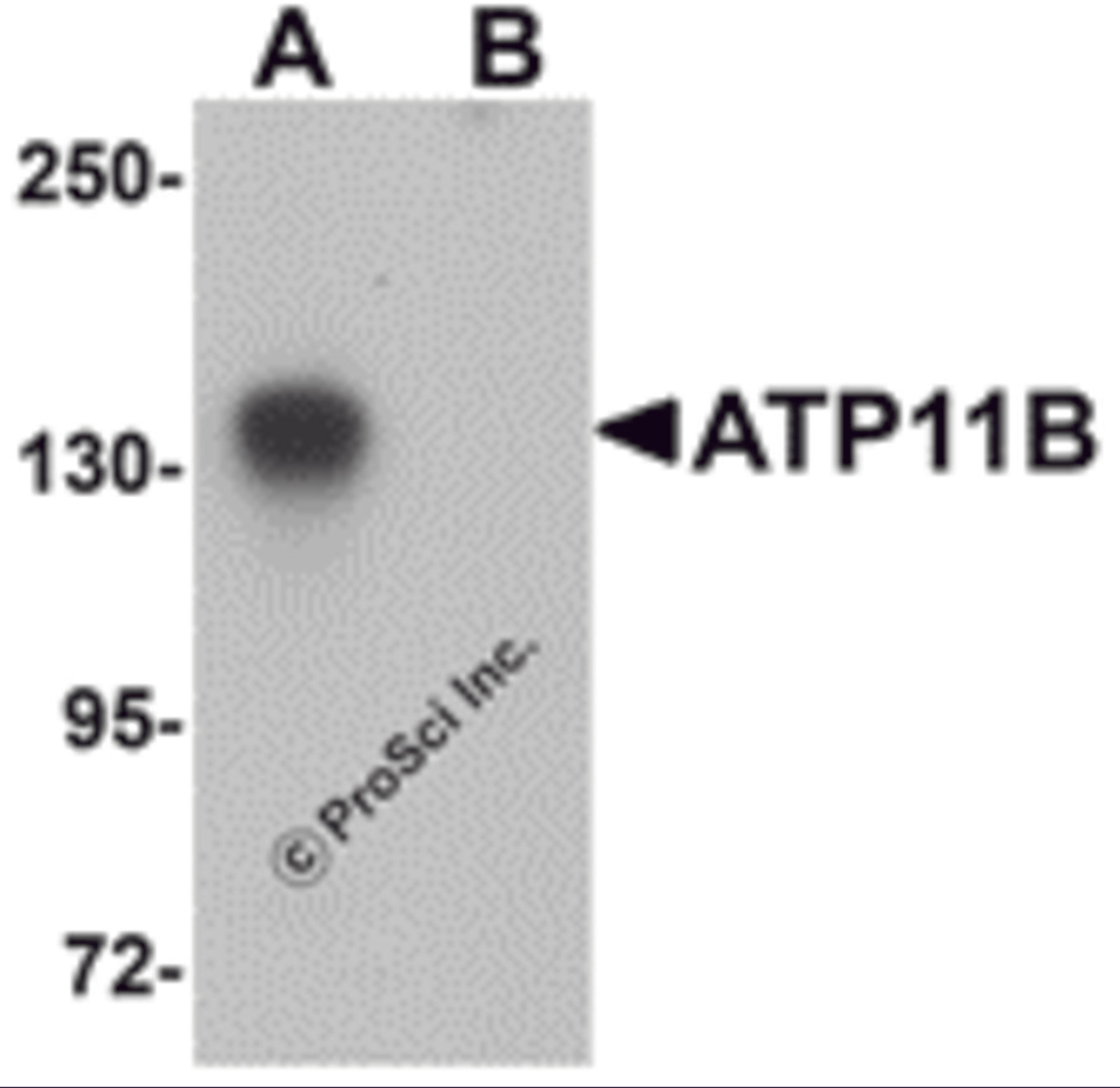 Western blot analysis of ATP11B in K562 cell tissue lysate with ATP11B antibody at 1 μg/mL in (A) the absence and (B) the presence of blocking peptide.