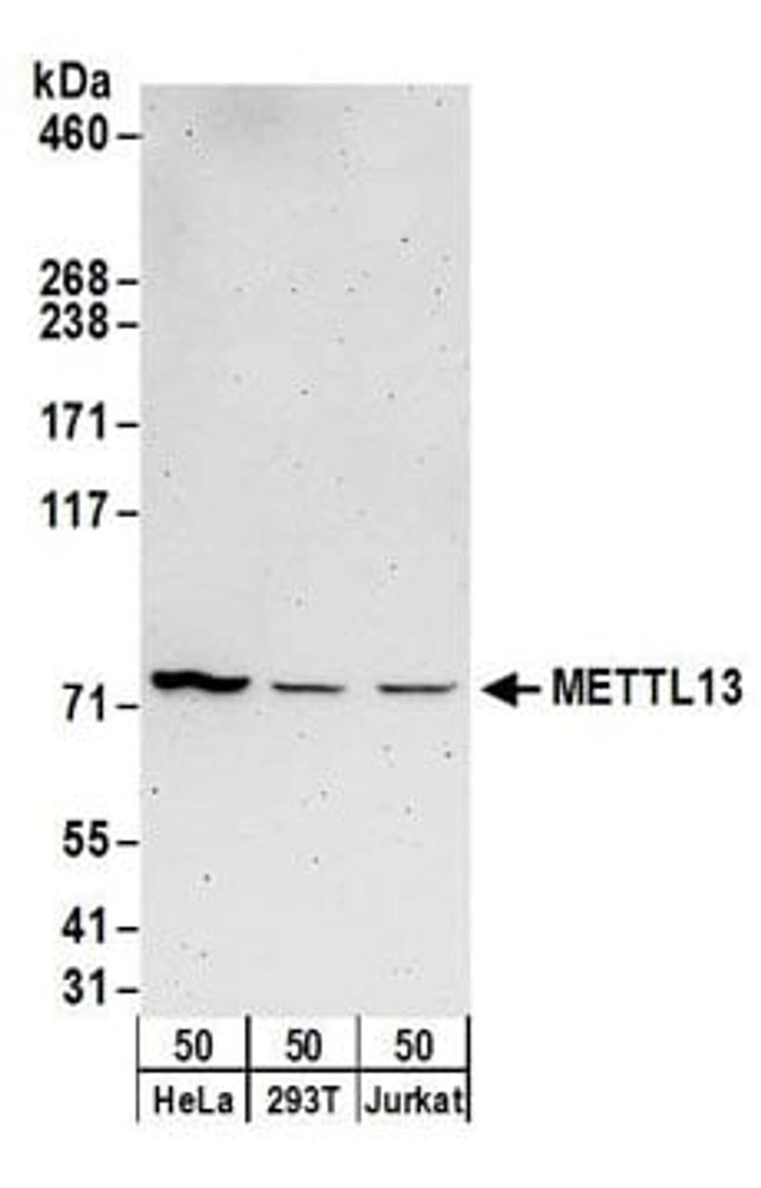 Detection of human METTL13 by western blot.