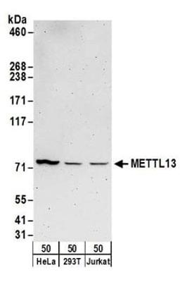 Detection of human METTL13 by western blot.