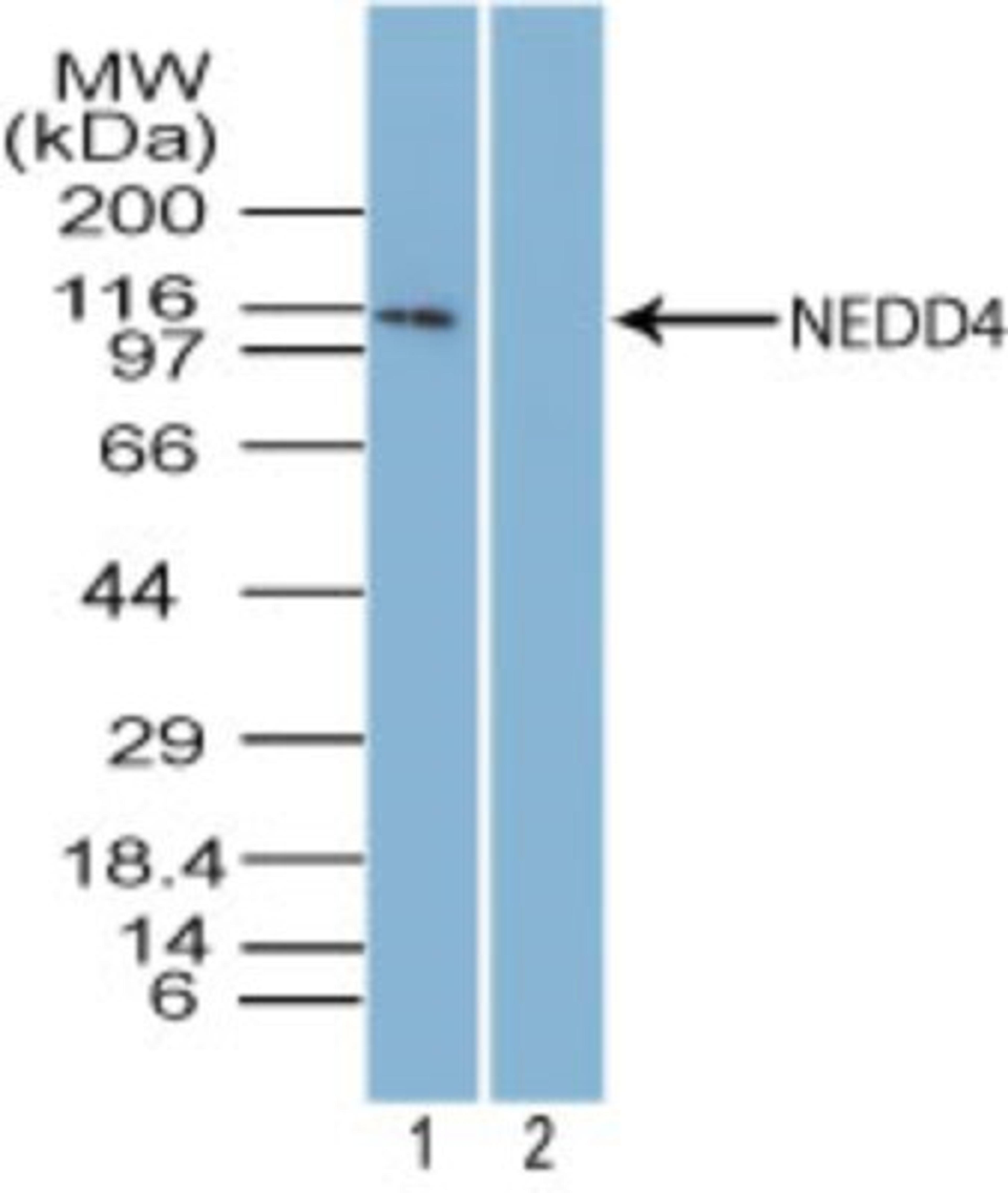 Western Blot: NEDD4 Antibody [NBP2-27197] - analysis of NEDD4 in mouse embryonic brain tissue lysate in the 1) absence and 2) presence of immunizing peptide using NEDD4 antibody at 5 ug/ml. I goat anti-rabbit Ig HRP secondary antibody and PicoTect ECL substrate solution were used for this test.