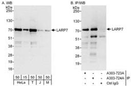 Detection of human and mouse LARP7 by western blot (h and m) and immunoprecipitation (h).