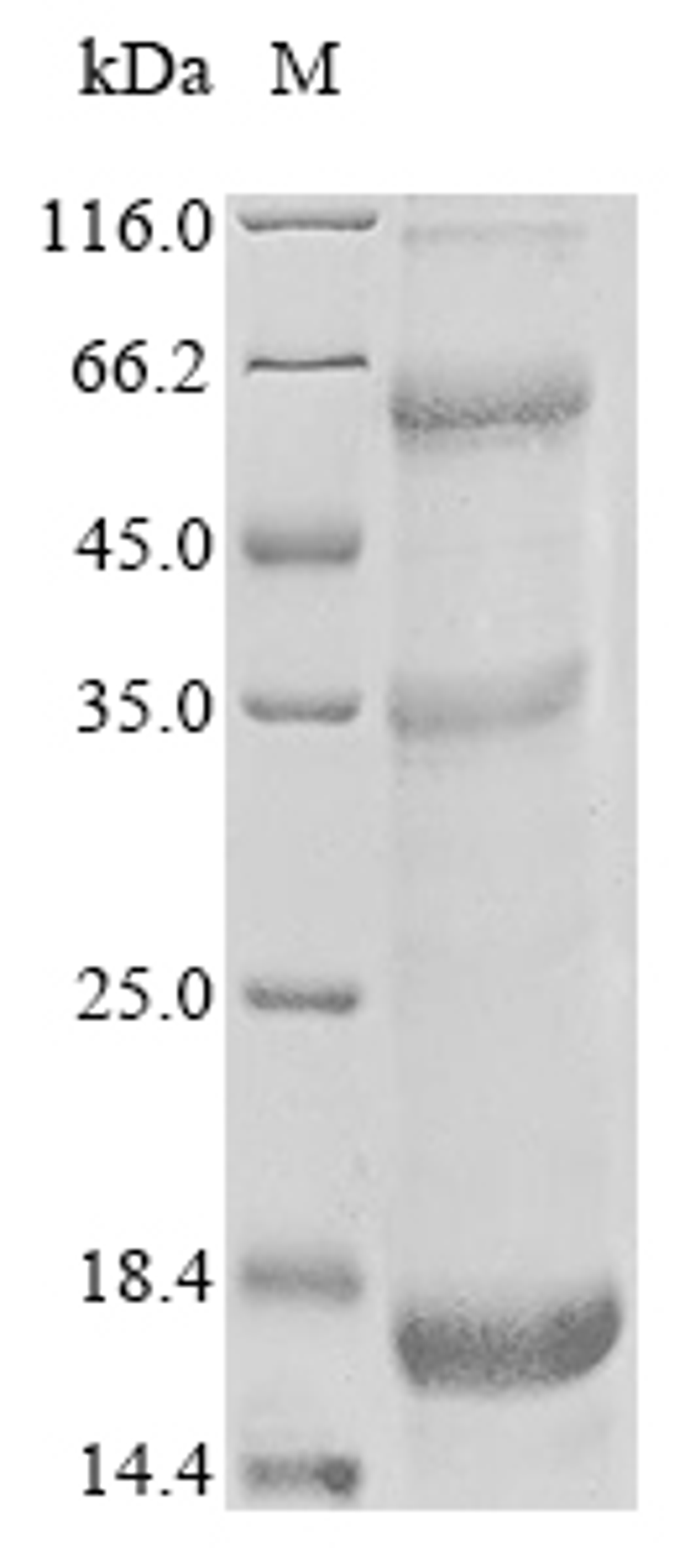 (Tris-Glycine gel) Discontinuous SDS-PAGE (reduced) with 5% enrichment gel and 15% separation gel.