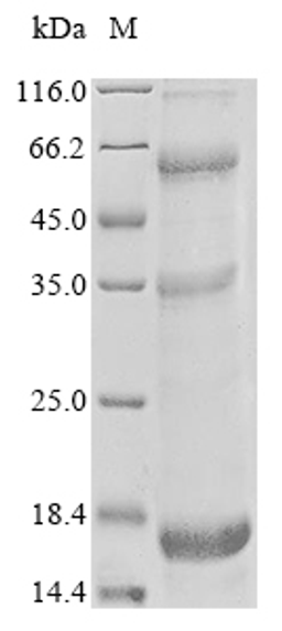 (Tris-Glycine gel) Discontinuous SDS-PAGE (reduced) with 5% enrichment gel and 15% separation gel.