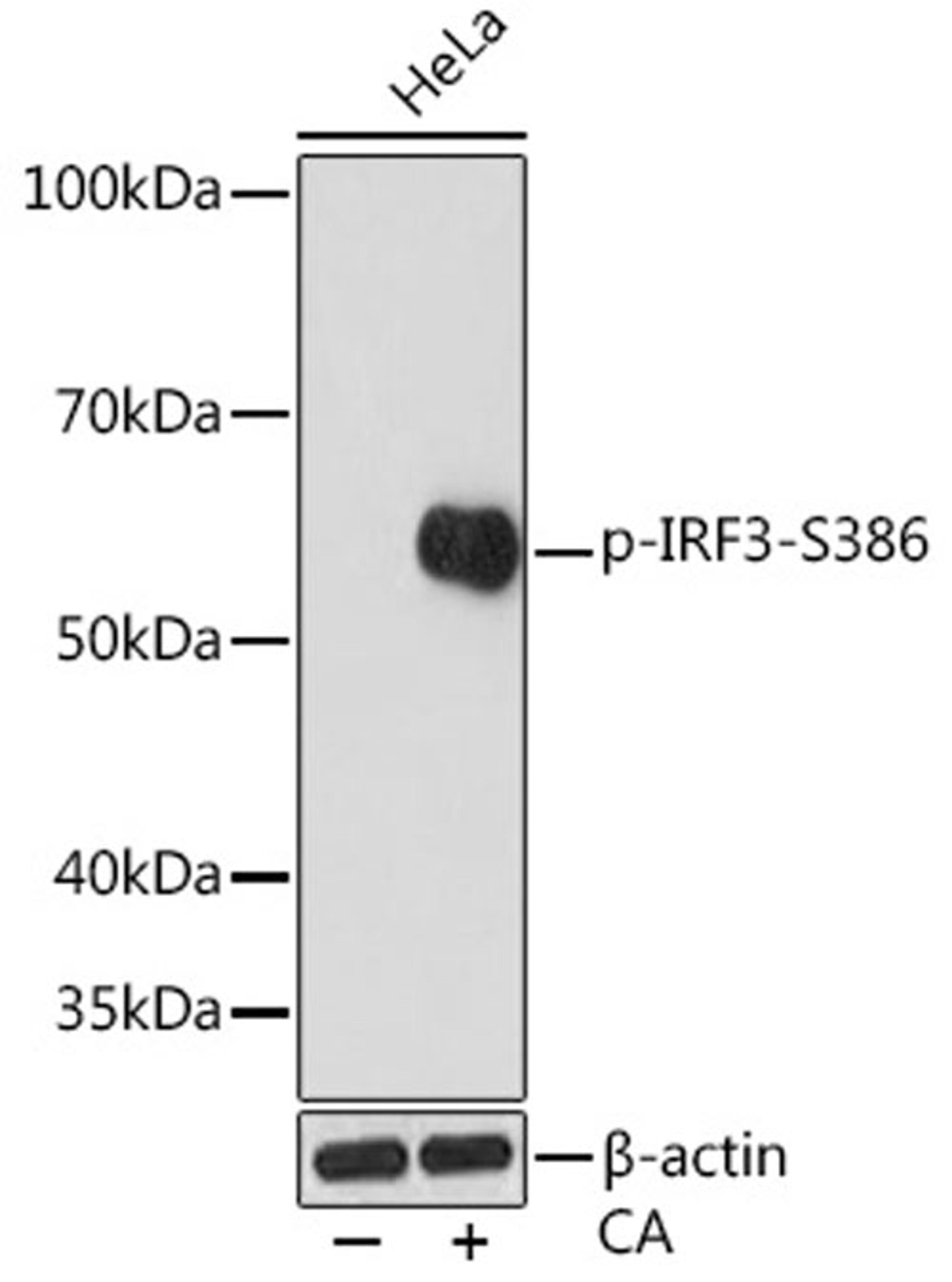 Western blot - Phospho-IRF3-S386 Rabbit mAb (AP0995)