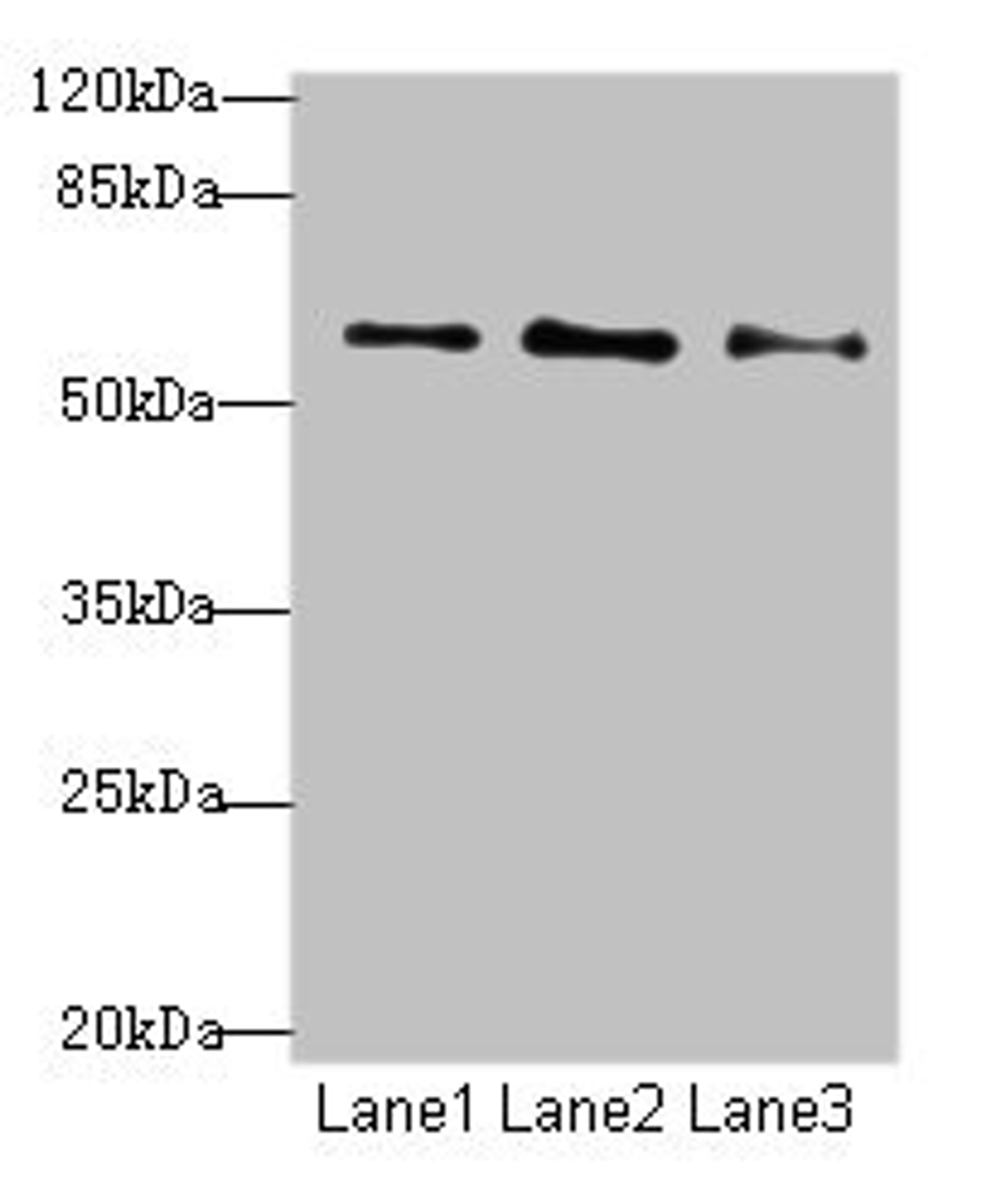 Western blot. All lanes: GPR101 antibody at 6µg/ml. Lane 1: MCF-7 whole cell lysate. Lane 2: U87 whole cell lysate. Lane 3: Caco-2 whole cell lysate. Secondary. Goat polyclonal to rabbit IgG at 1/10000 dilution. Predicted band size: 57 kDa. Observed band size: 57 kDa
