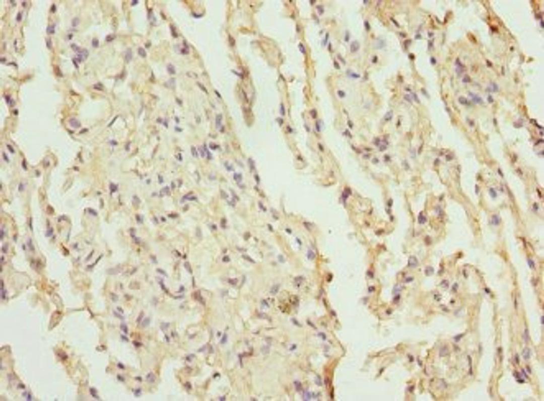 Immunohistochemical staining of human lung tissue using CEP120 antibody