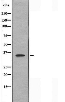 Western blot analysis of Jurkat cells using OR8J1 antibody