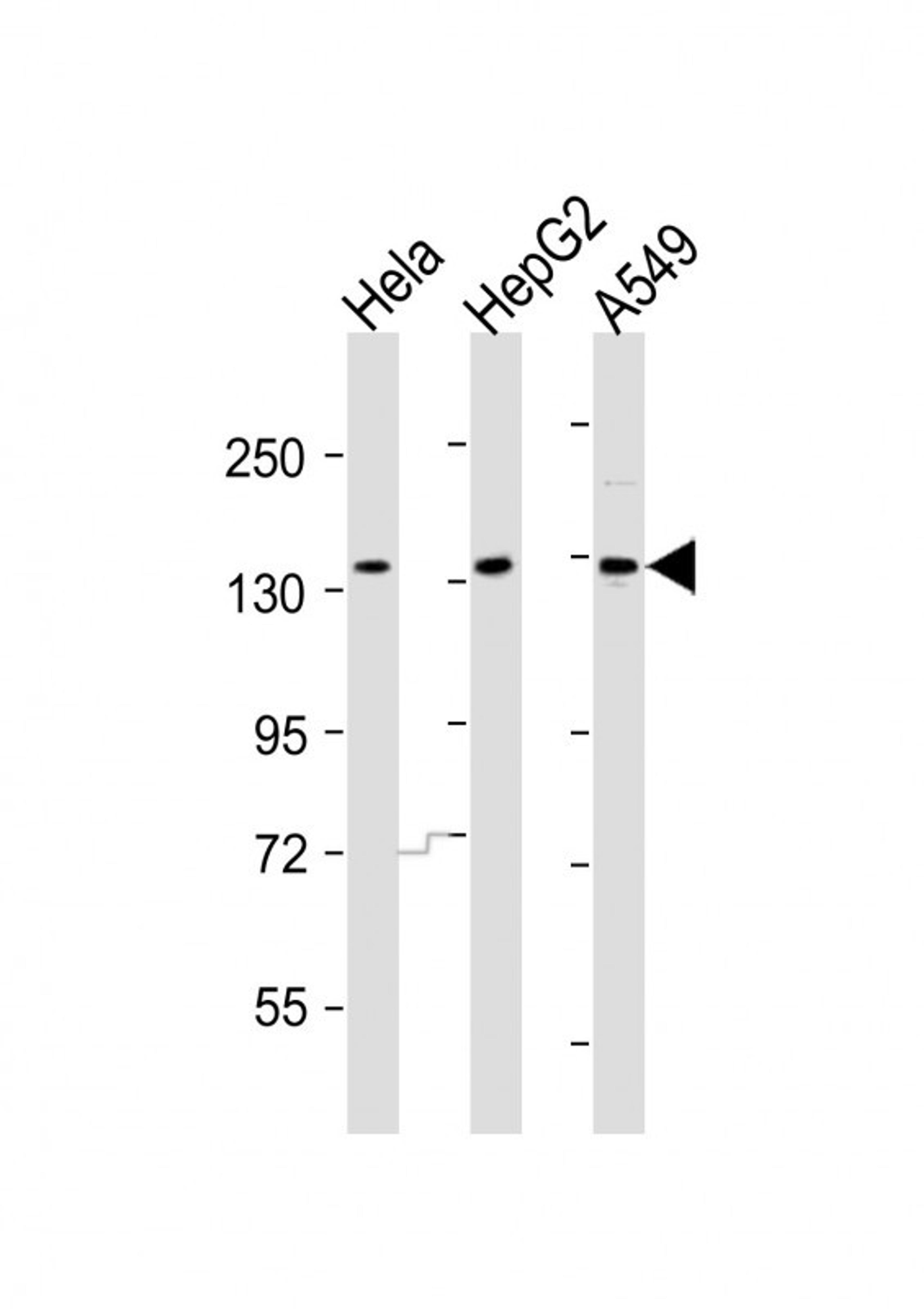 Western Blot at 1:2000 dilution Lane 1: Hela whole cell lysates Lane 2: HepG2 whole cell lysates Lane 3: A549 whole cell lysates Lysates/proteins at 20 ug per lane.