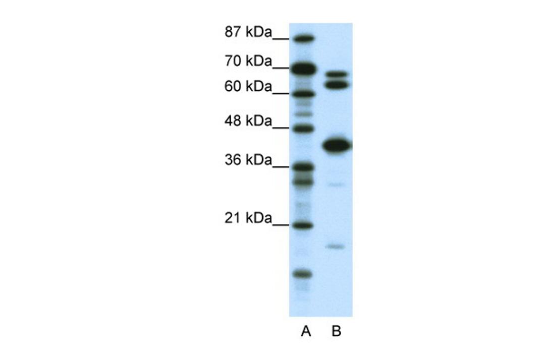 Antibody used in WB on Human Jurkat 0.2-1 ug/ml.