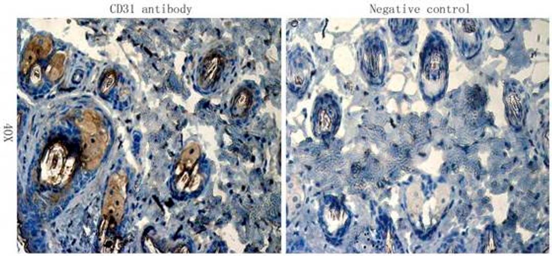 IHC-P staining of mouse skin tissue using CD31 antibody (dilution at 1:100)