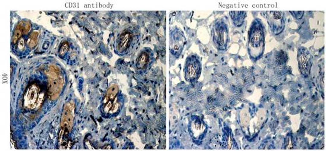 IHC-P staining of mouse skin tissue using CD31 antibody (dilution at 1:100)