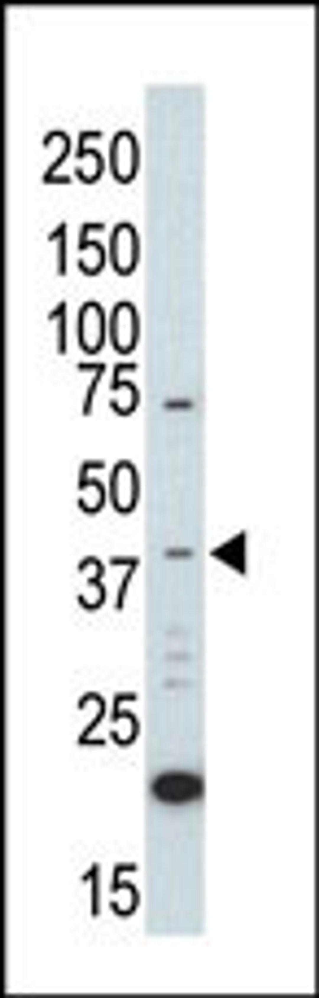 Western blot analysis of anti-ERK2 C-term Pab in UV-treated HL-60 cell lysate