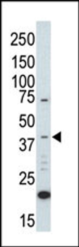 Western blot analysis of anti-ERK2 C-term Pab in UV-treated HL-60 cell lysate