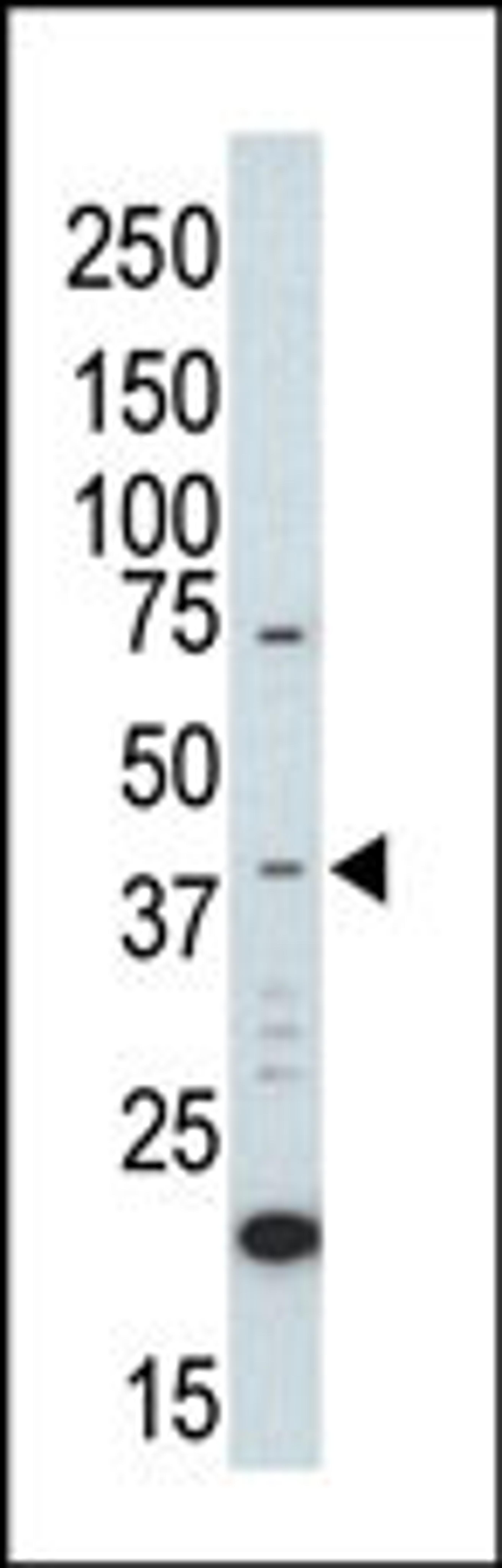 Western blot analysis of anti-ERK2 C-term Pab in UV-treated HL-60 cell lysate