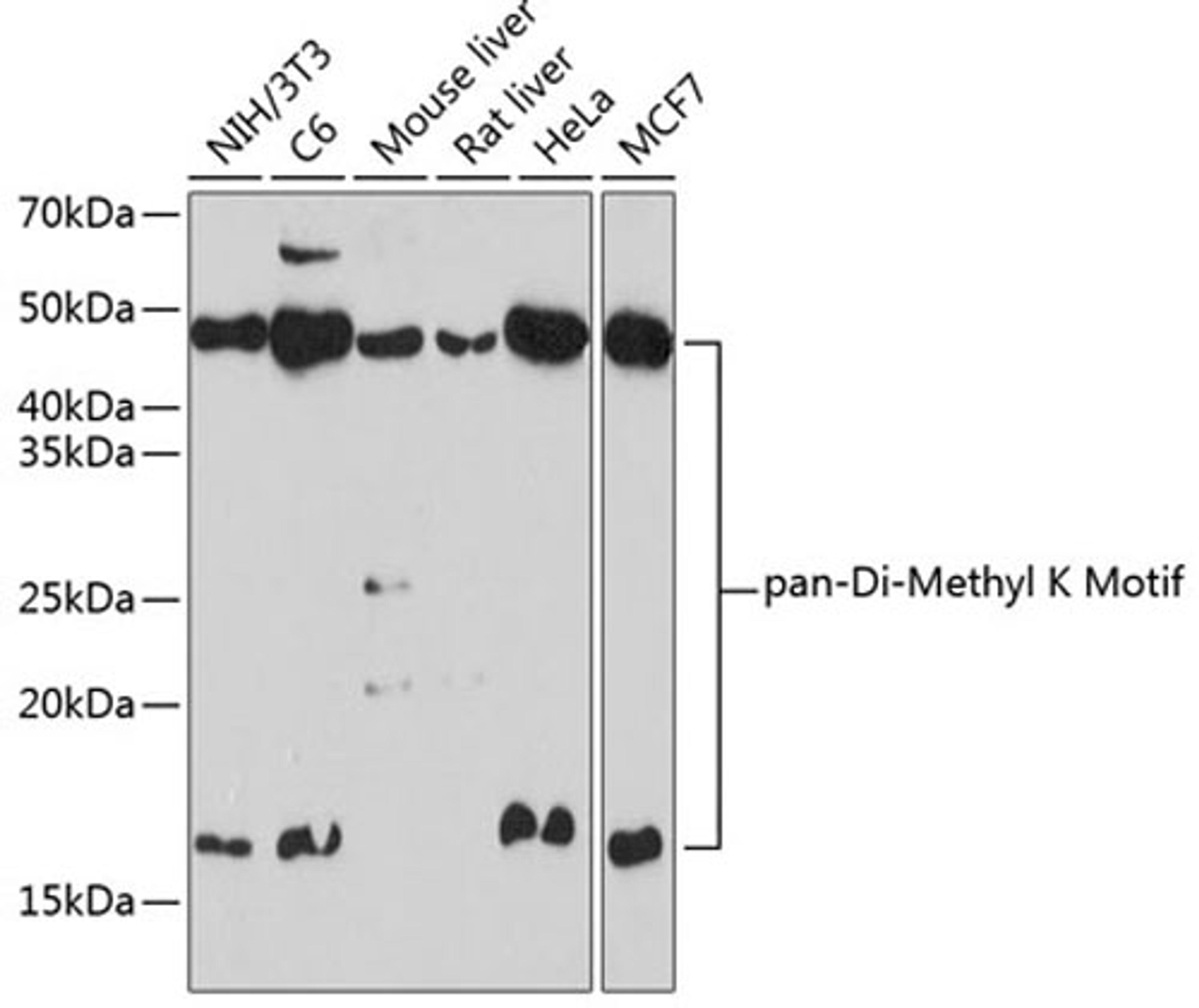 Western blot - pan-Di-Methyl K Motif pAb (A18296)