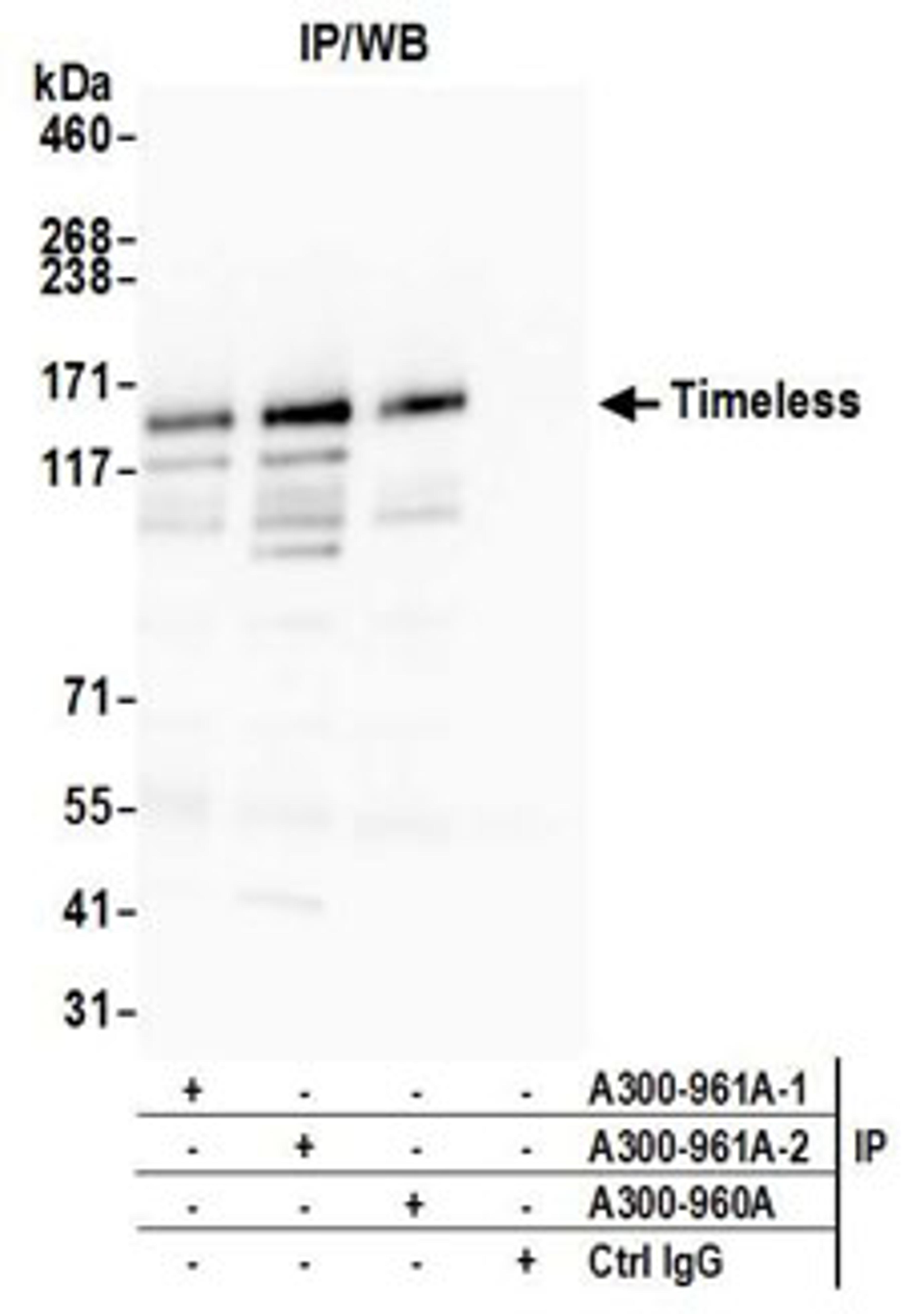 Detection of human Timeless by western blot of immunoprecipitates.