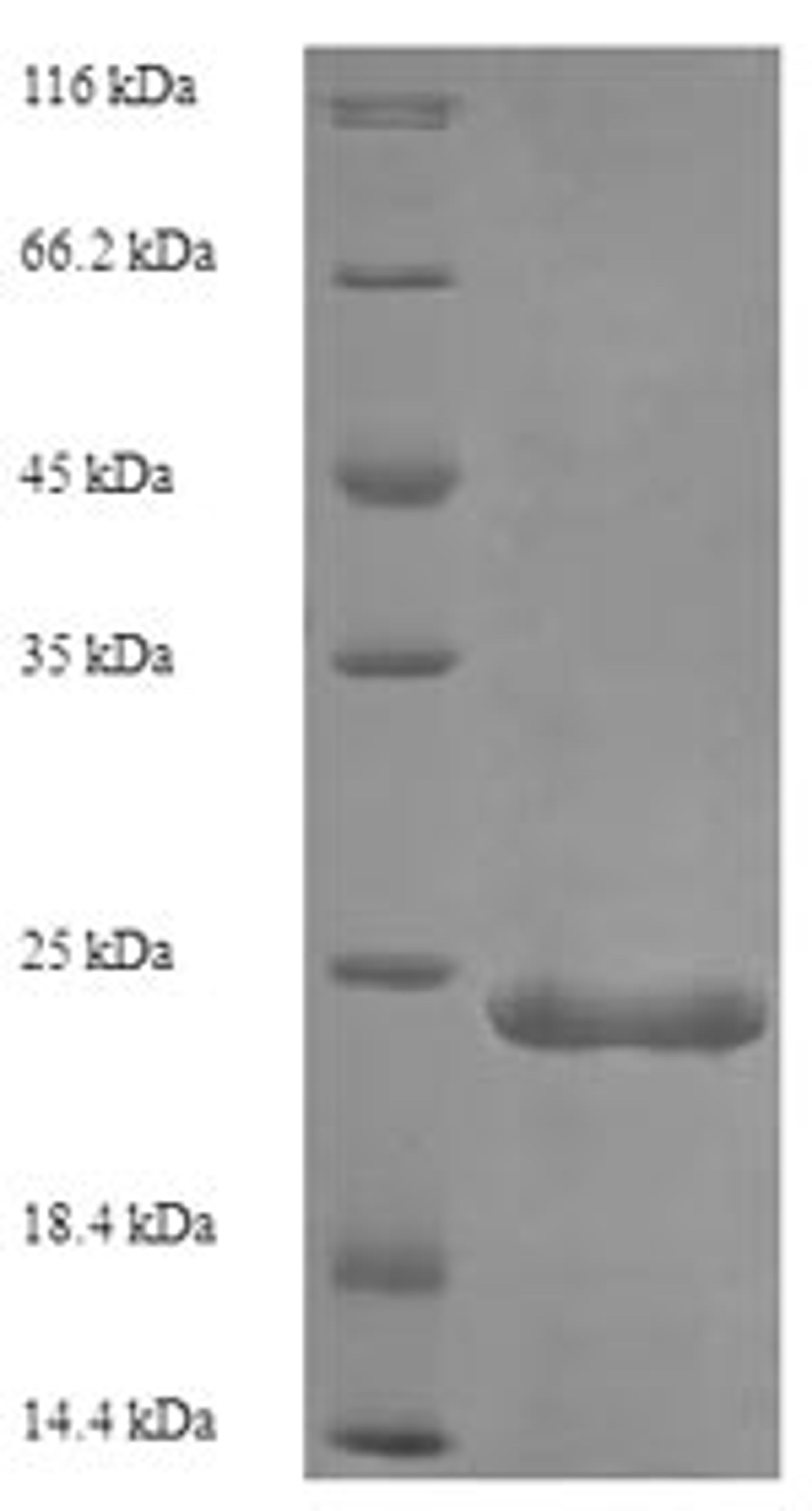 (Tris-Glycine gel) Discontinuous SDS-PAGE (reduced) with 5% enrichment gel and 15% separation gel.