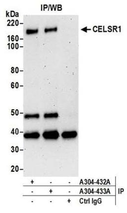 Detection of human CELSR1 by western blot of immunoprecipitates.