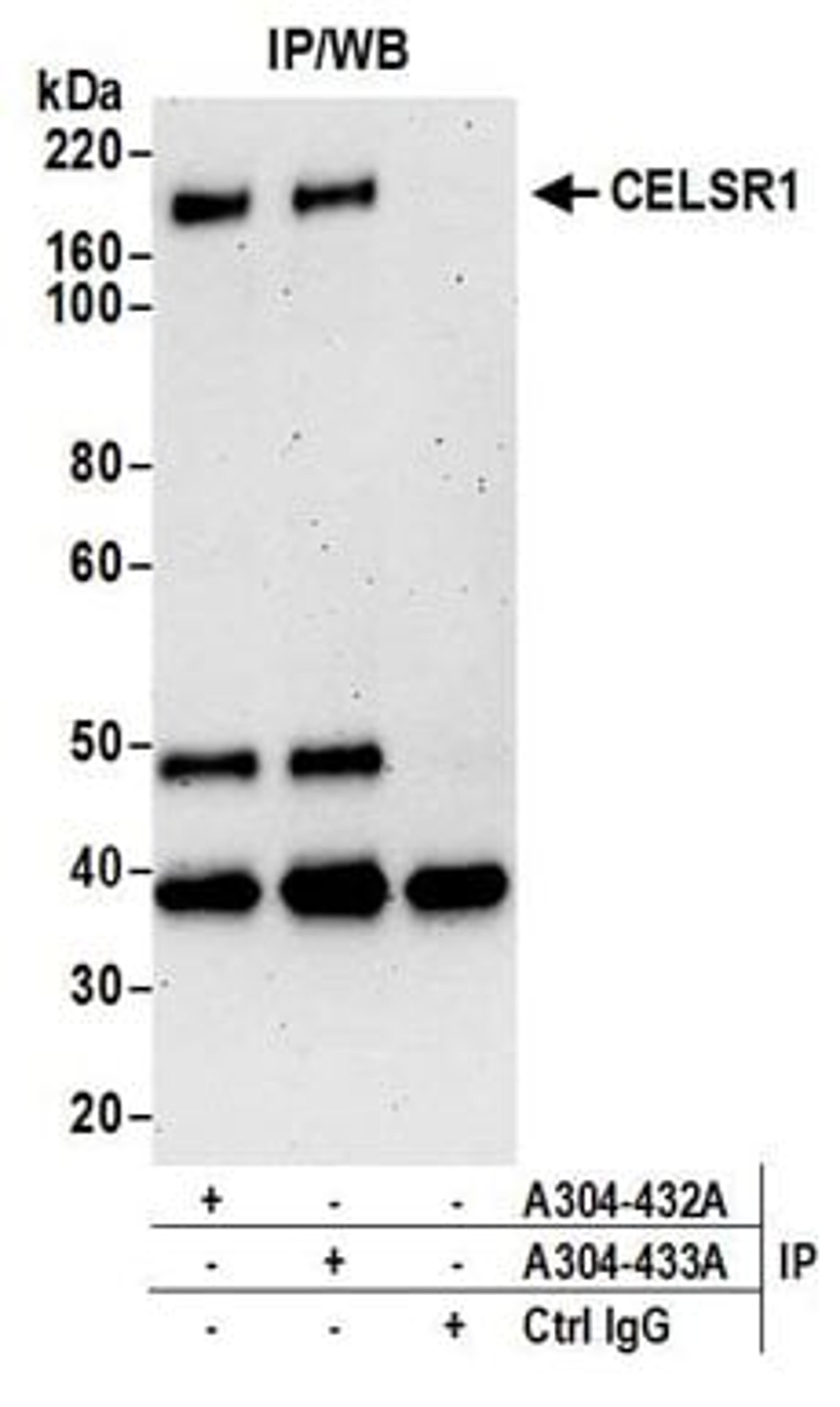 Detection of human CELSR1 by western blot of immunoprecipitates.