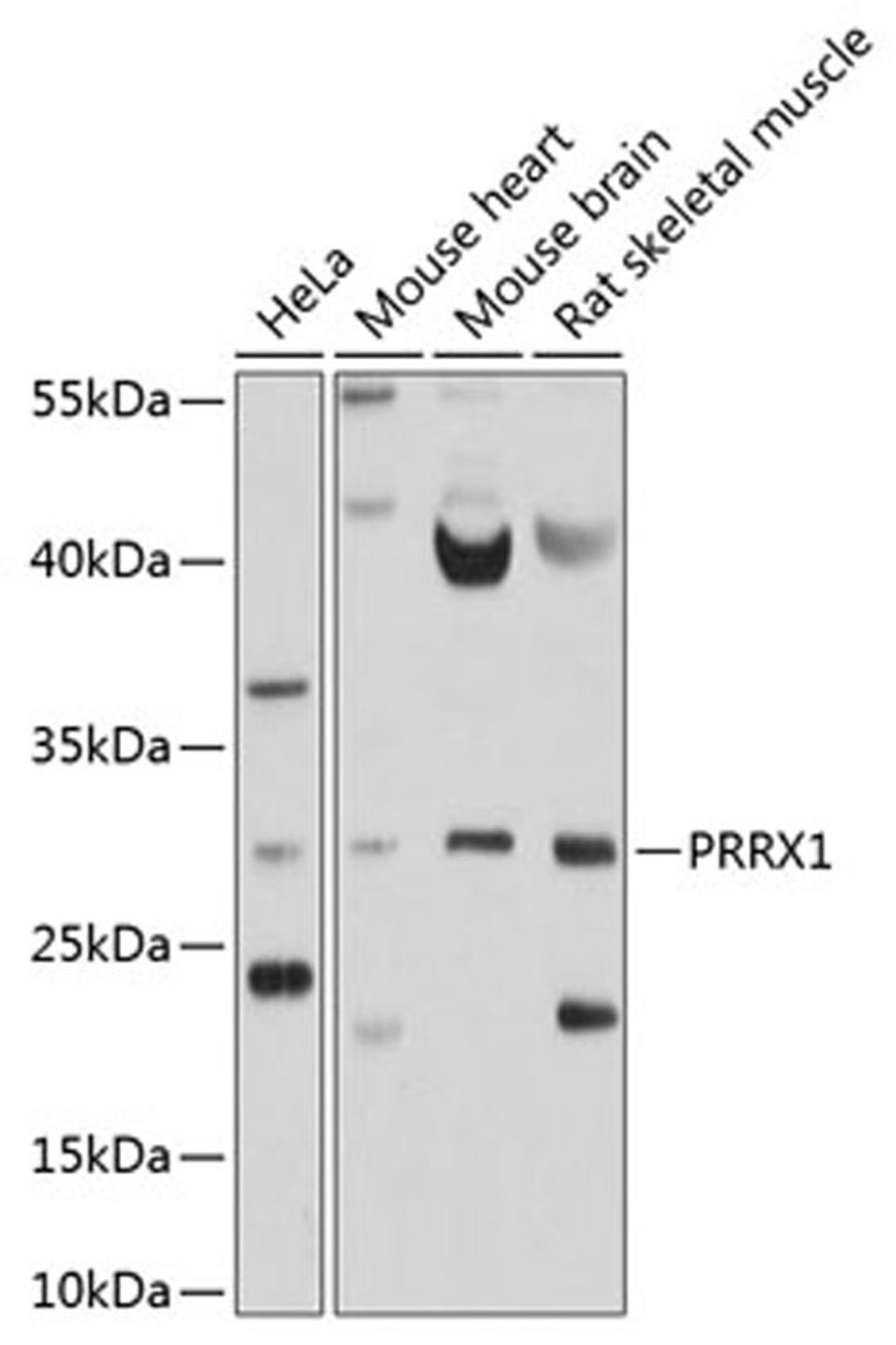 Western blot - PRRX1 antibody (A10237)