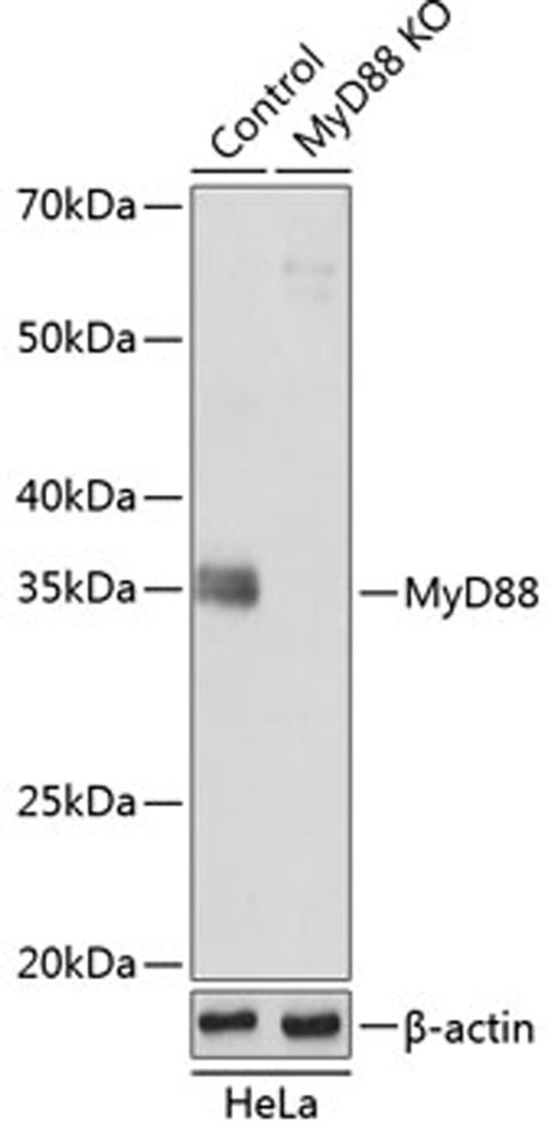 Western blot - MyD88 antibody (A19082)