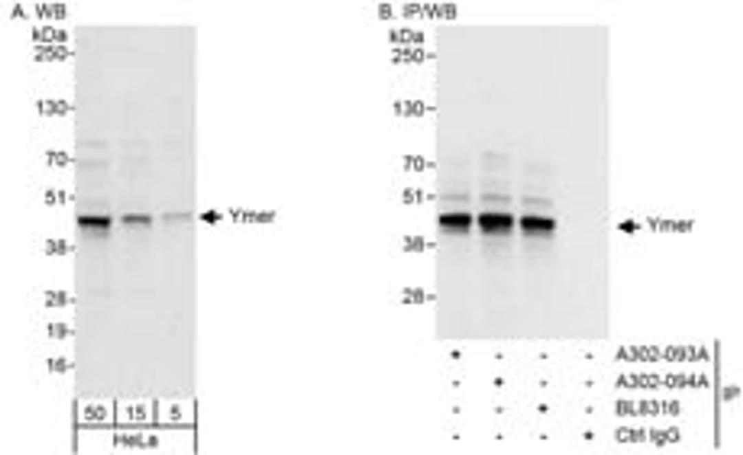 Detection of human Ymer by western blot and immunoprecipitation.