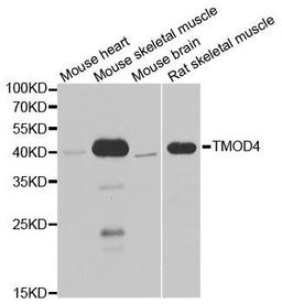 Western blot analysis of extracts of various cell lines using TMOD4 antibody