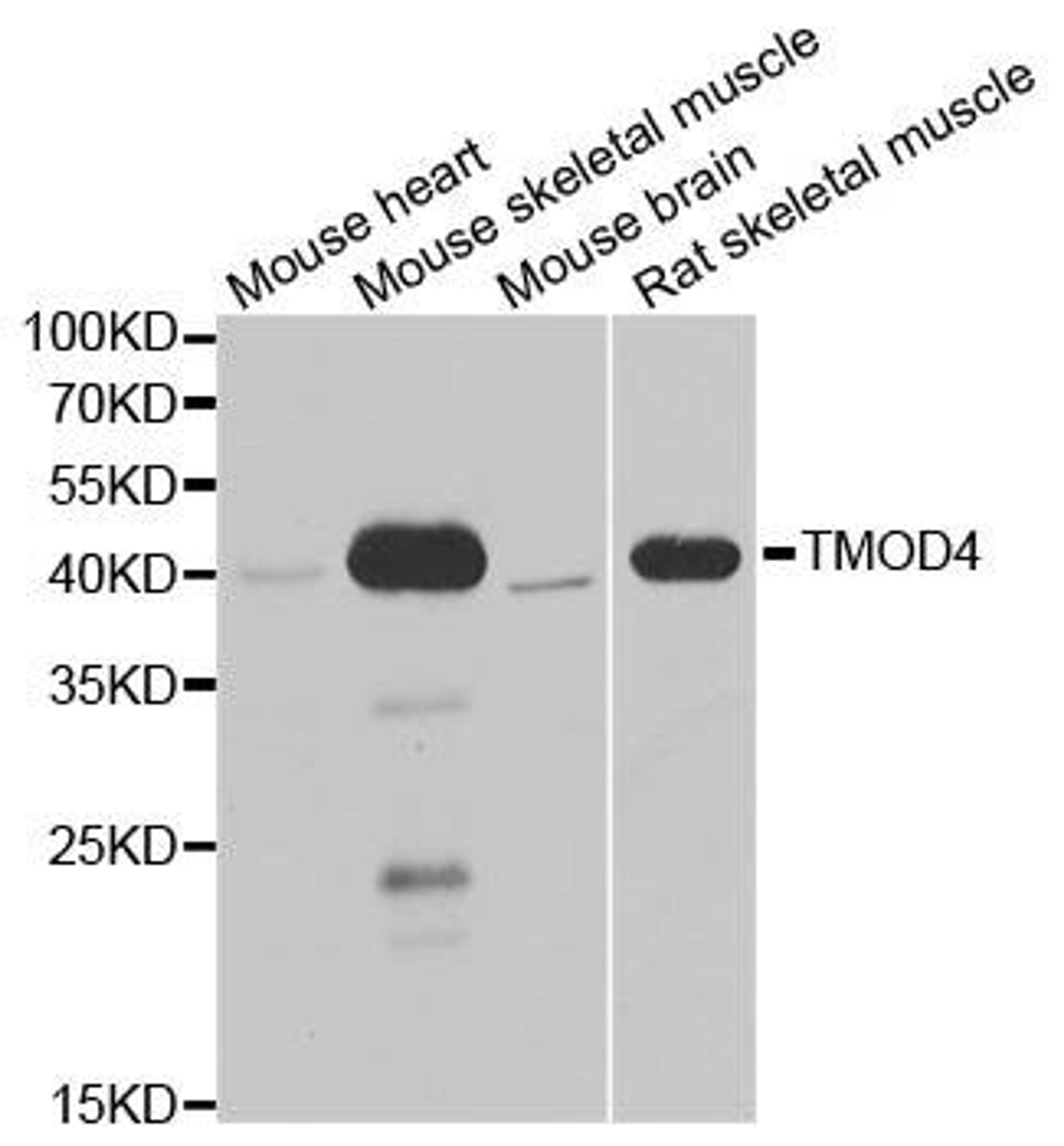 Western blot analysis of extracts of various cell lines using TMOD4 antibody