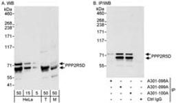 Detection of human and mouse PPP2R5D by western blot (h&m) and immunoprecipitation (h).