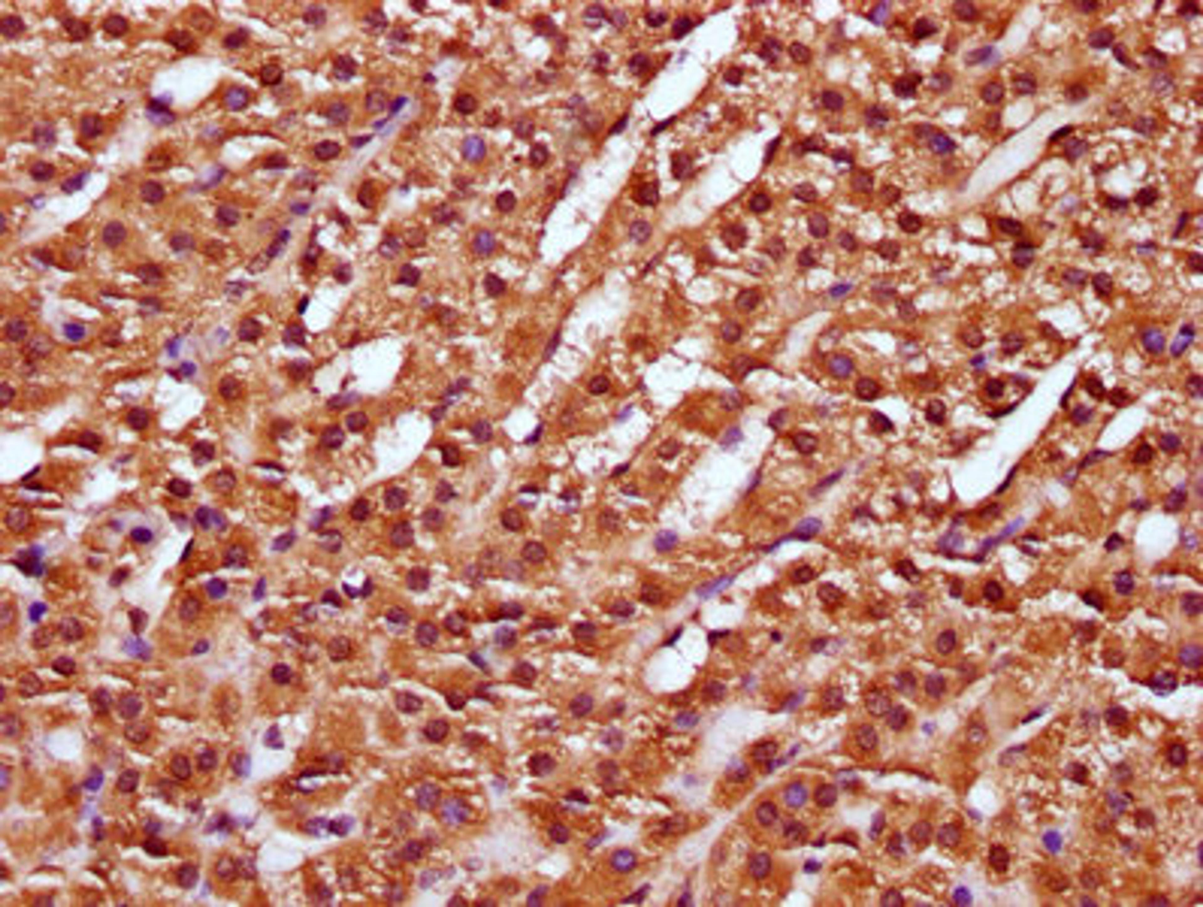 IHC image of CSB-PA896918LA01HU diluted at 1:100 and staining in paraffin-embedded human adrenal gland tissue performed on a Leica BondTM system. After dewaxing and hydration, antigen retrieval was mediated by high pressure in a citrate buffer (pH 6.0). Section was blocked with 10% normal goat serum 30min at RT. Then primary antibody (1% BSA) was incubated at 4&deg;C overnight. The primary is detected by a biotinylated secondary antibody and visualized using an HRP conjugated SP system.
