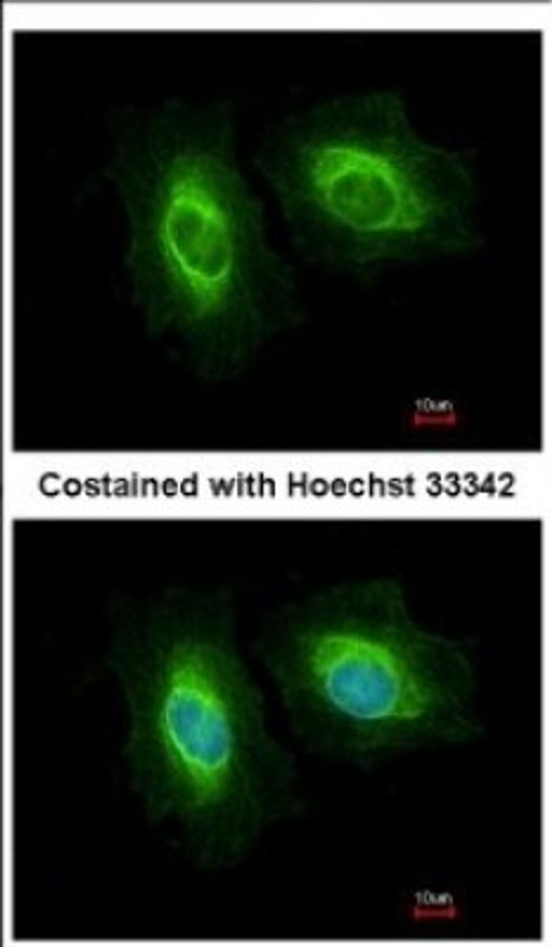 Immunocytochemistry/Immunofluorescence: SASS6 Antibody [NBP2-20264] - Immunofluorescence analysis of methanol-fixed HeLa, using antibody at 1:200 dilution.