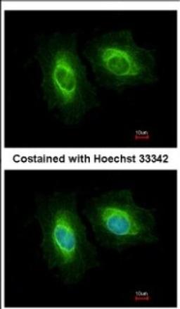 Immunocytochemistry/Immunofluorescence: SASS6 Antibody [NBP2-20264] - Immunofluorescence analysis of methanol-fixed HeLa, using antibody at 1:200 dilution.