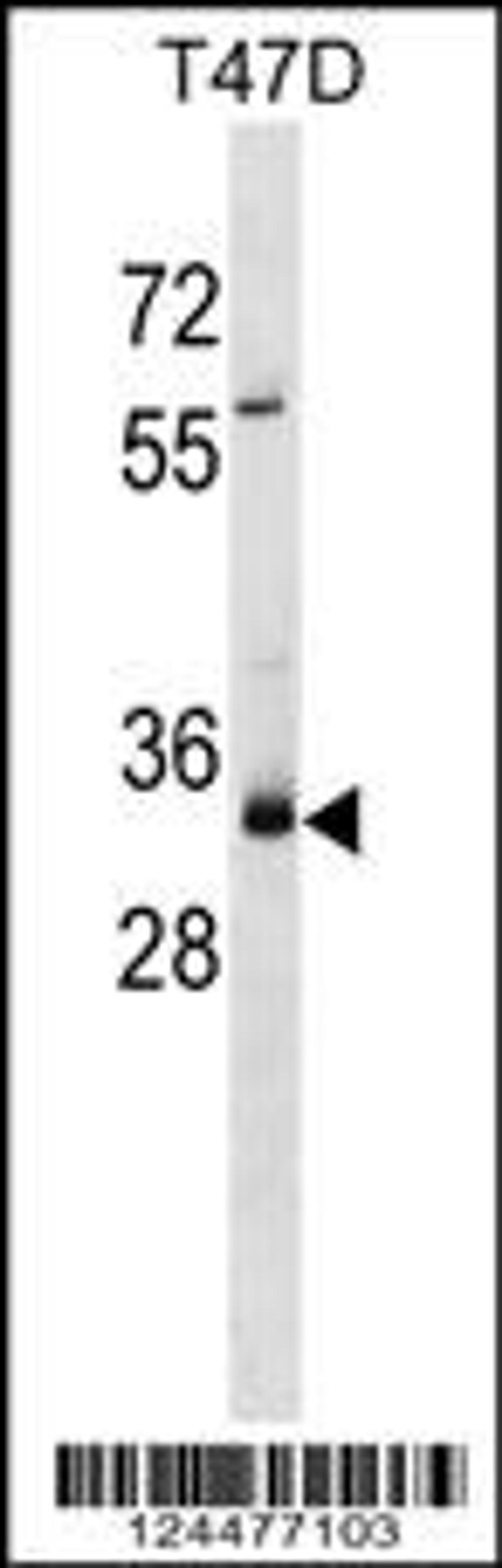 Western blot analysis in T47D cell line lysates (35ug/lane).