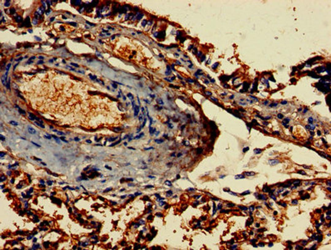 Immunohistochemistry of paraffin-embedded human lung tissue using CSB-PA008533LA01HU at dilution of 1:100