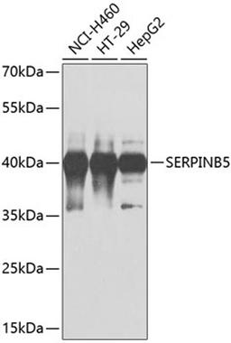 Western blot - SERPINB5 antibody (A1179)