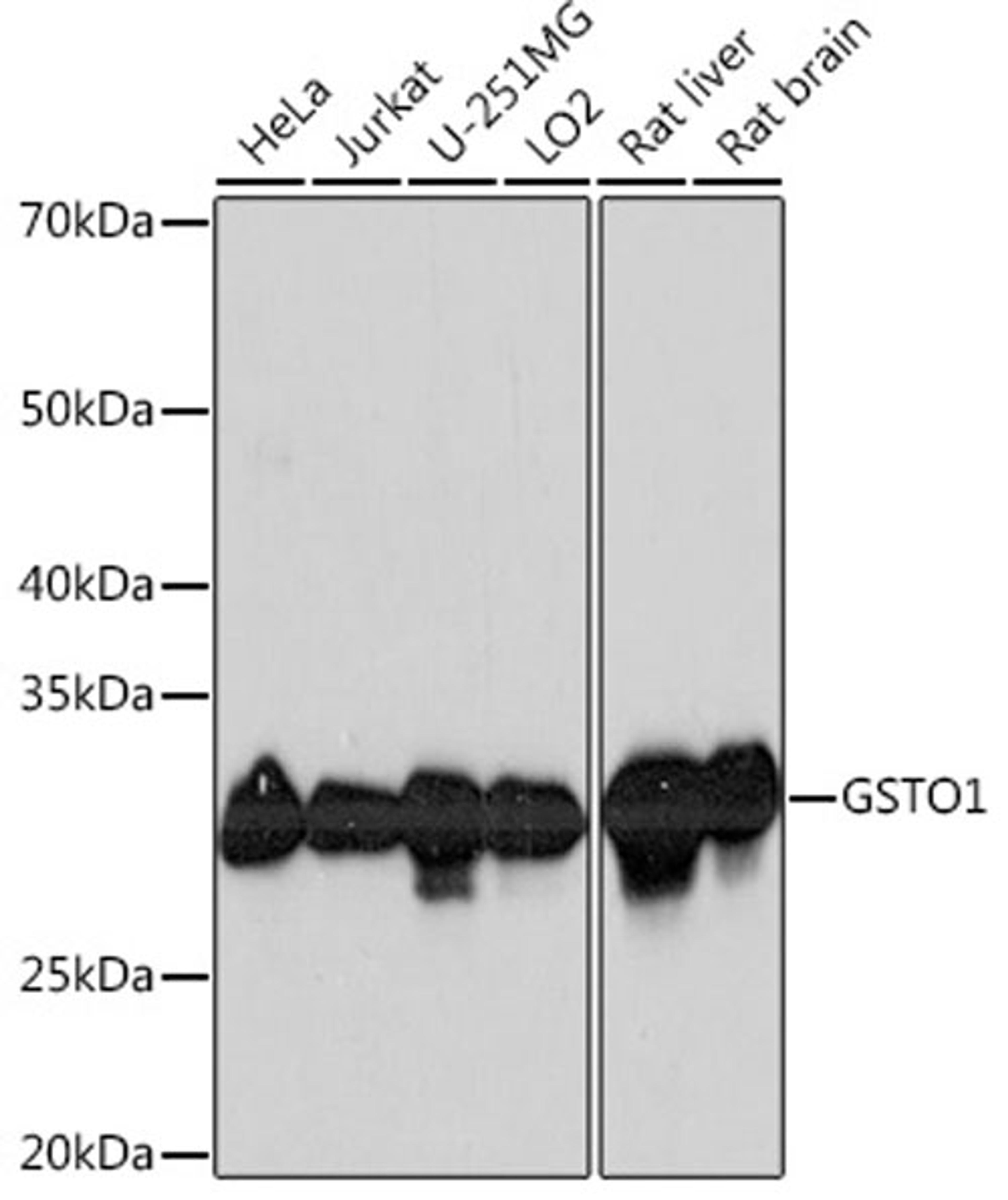 Western blot - GSTO1 Rabbit mAb (A4636)