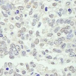 Detection of mouse KPNA3 by immunohistochemistry.