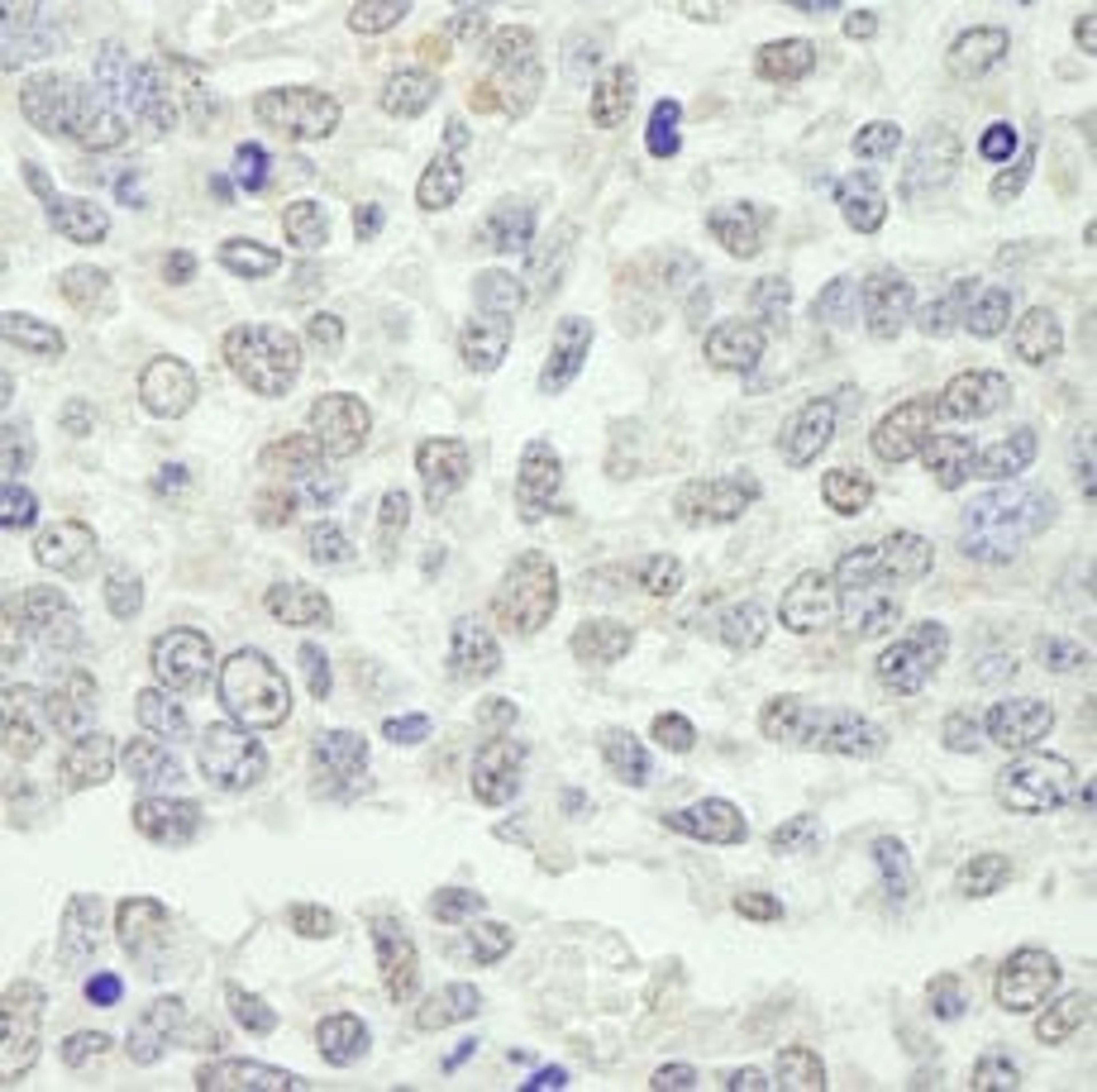 Detection of mouse KPNA3 by immunohistochemistry.