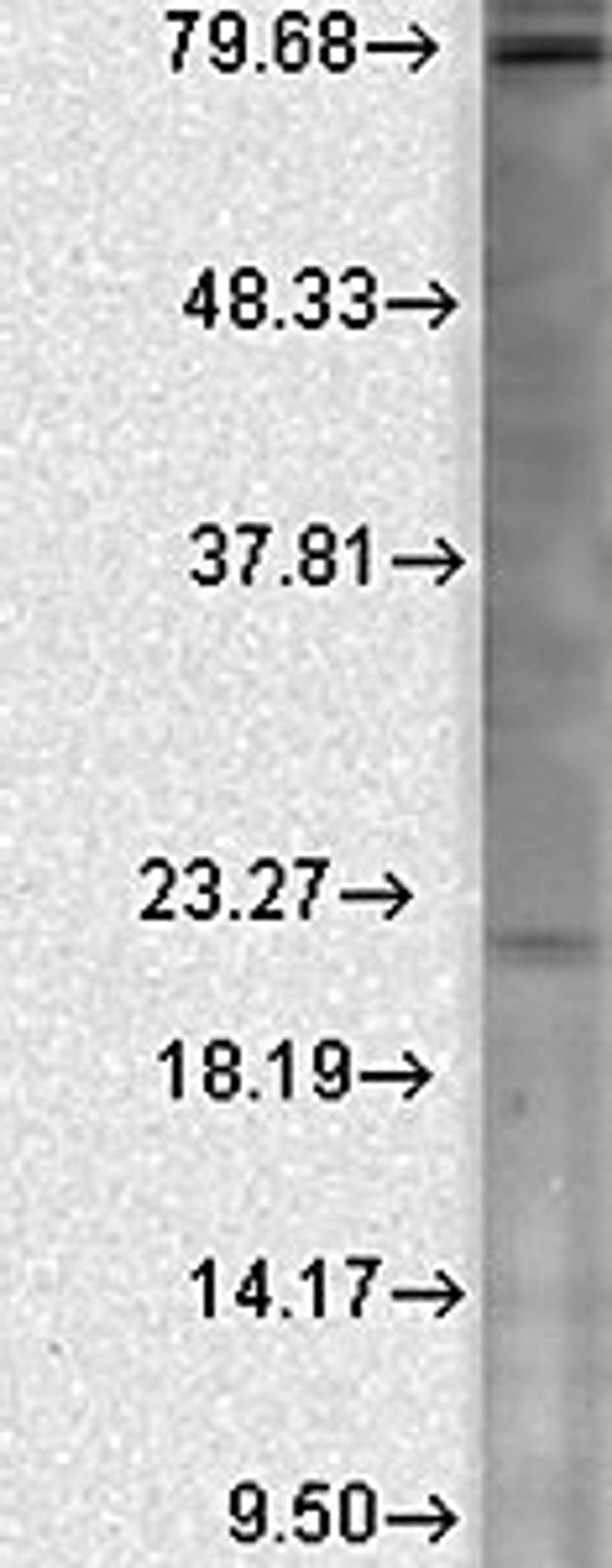 Western blot analysis of human cell line mix using CaVbeta2 antibody