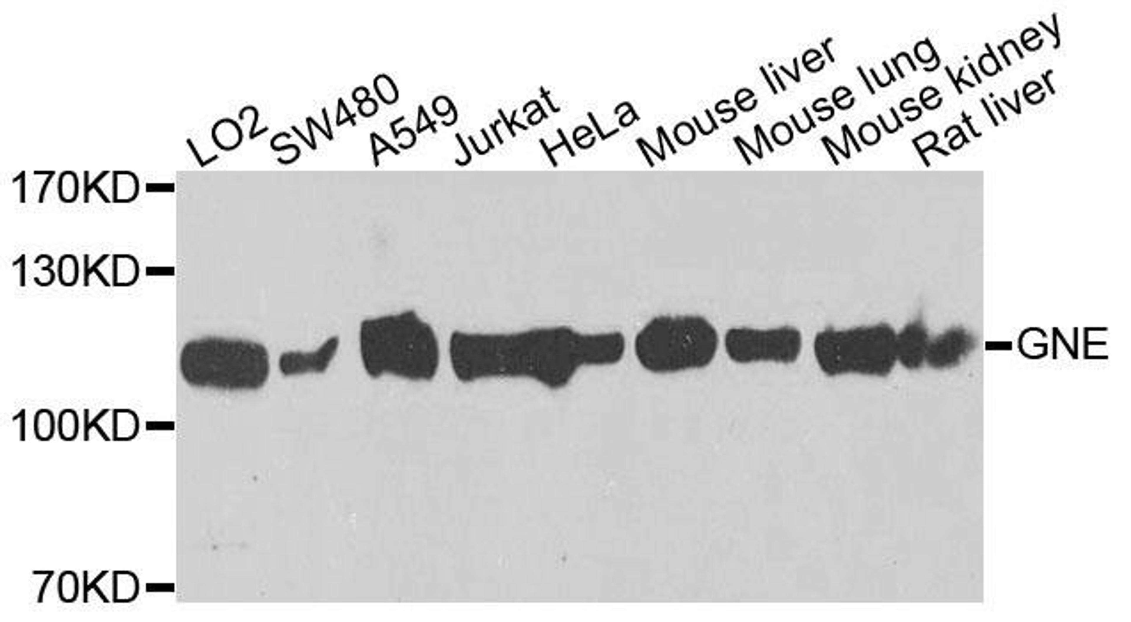 Western blot analysis of extracts of various cells using GNE antibody