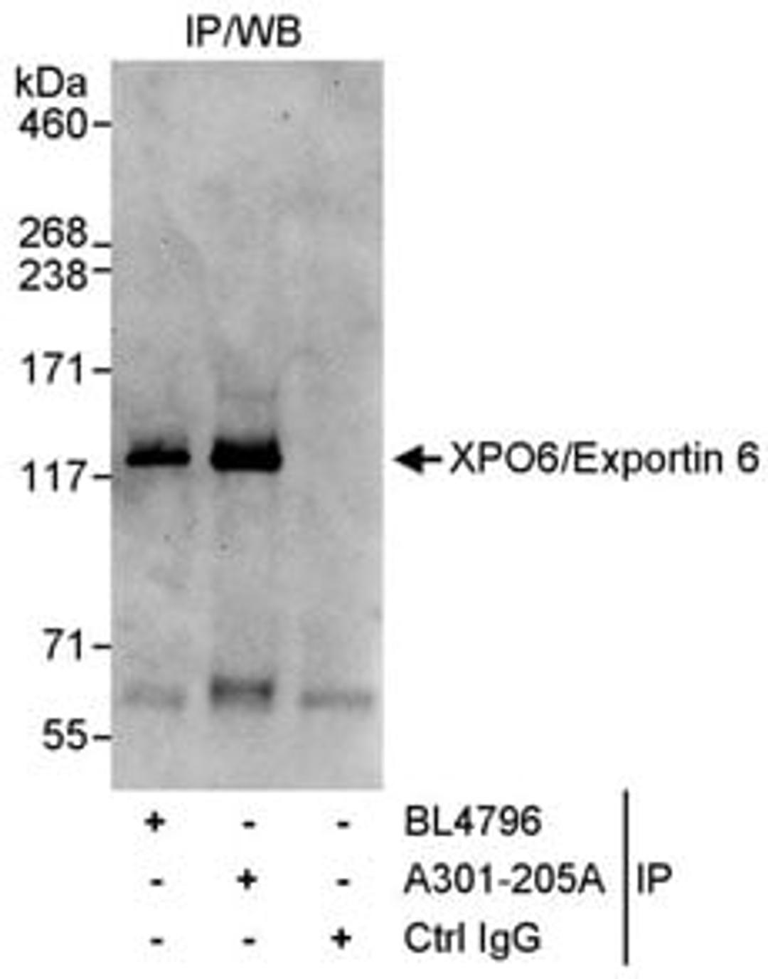 Detection of human XPO6/Exportin 6 by western blot of immunoprecipitates.