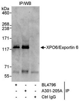 Detection of human XPO6/Exportin 6 by western blot of immunoprecipitates.