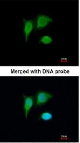 Immunocytochemistry/Immunofluorescence: PIG3 Antibody [NBP1-33237] - Paraformaldehyde-fixed A549, using antibody at 1:200 dilution.