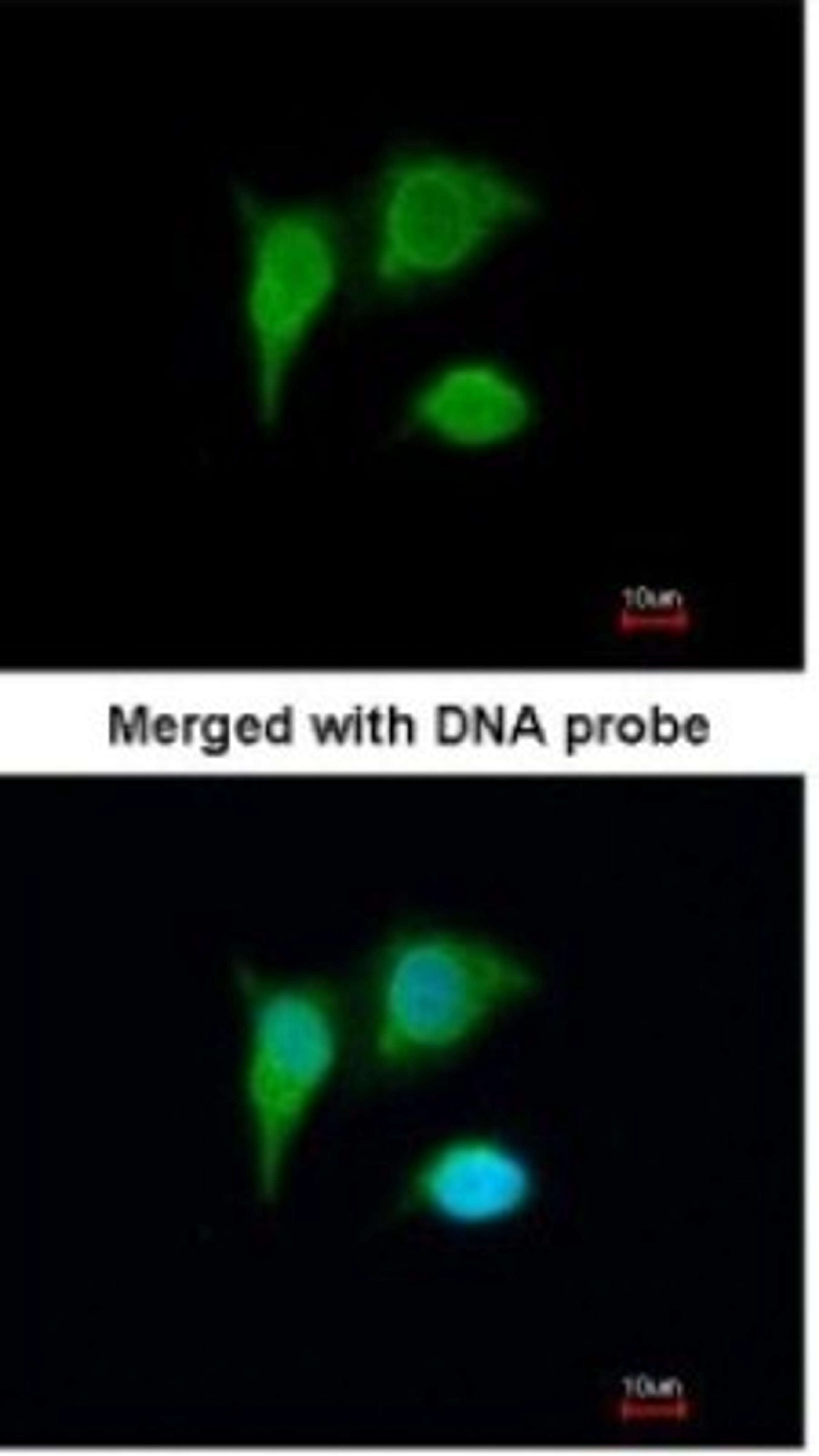 Immunocytochemistry/Immunofluorescence: PIG3 Antibody [NBP1-33237] - Paraformaldehyde-fixed A549, using antibody at 1:200 dilution.