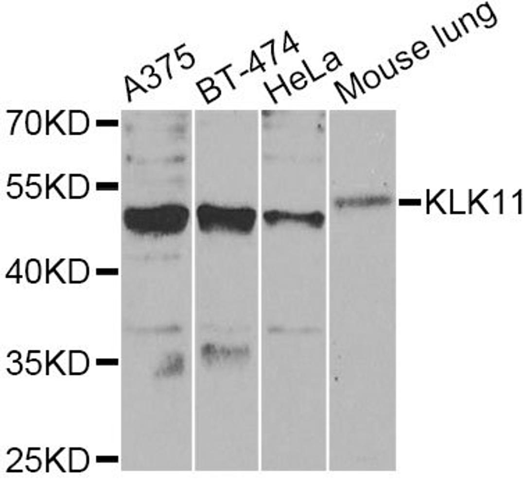 Western blot - KLK11 Antibody (A6641)