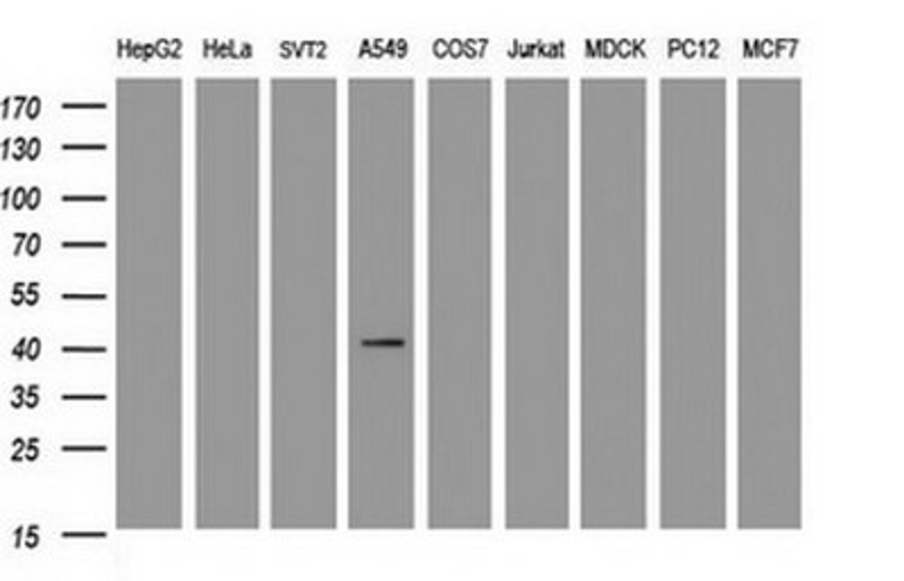 Western Blot: Carbonic Anhydrase XII/CA12 Antibody (2C6) [NBP2-46042] - Analysis of extracts (35ug) from 9 different cell lines. (HepG2: human; HeLa: human; SVT2: mouse; A549: human; COS7: monkey; Jurkat: human; MDCK: canine; PC12: rat; MCF7: human).