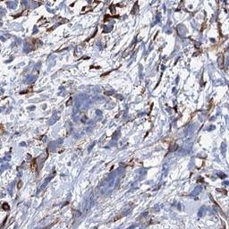 Immunohistochemistry: MAP1A Antibody [NBP2-32630] - breast cancer