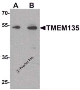 Western blot analysis of TMEM135 in rat liver tissue lysate with TMEM135 antibody at (A) 1 and (B) 2 &#956;g/mL.