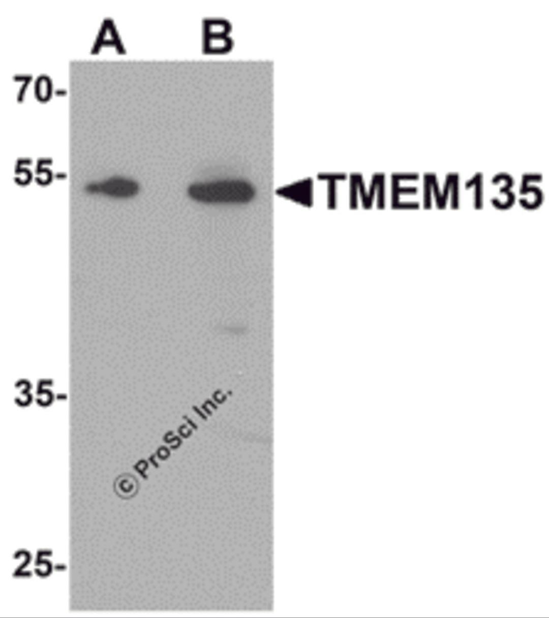 Western blot analysis of TMEM135 in rat liver tissue lysate with TMEM135 antibody at (A) 1 and (B) 2 μg/mL.